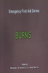 Emergency First Aid Series: Burns (1980)