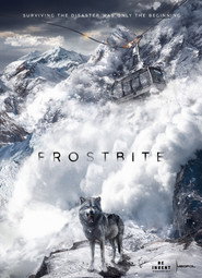 Frostbite