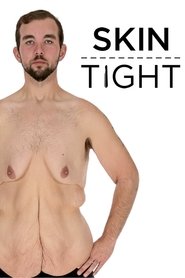 My 600-lb Life: Skin Tight My 600-lb Life: Skin Tight