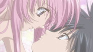 Kiss