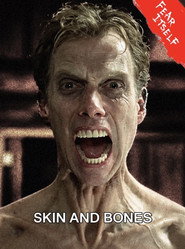 Skin and Bones постер