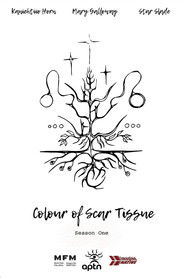 Colour of Scar Tissue