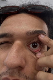 Conceição PH