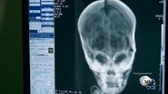 Peruvian Alien Skull & Baltic Sea UFO