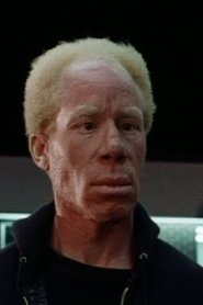 Bennie Robinson is Albino Trucker