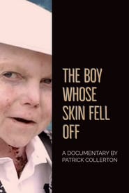 The Boy Whose Skin Fell Off постер