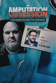 An Amputation Obsession: The Monster and the Surgeon