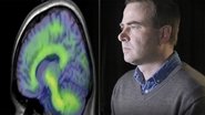 Alzheimer's - Can We Prevent It?