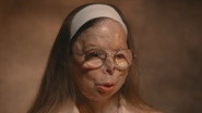 Acid-burned by the man she had just left, she is left disfigured.