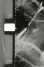 18 (+2) Blinks of an eye