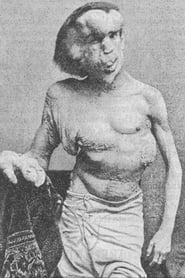 Joseph Merrick: The Real Elephant Man