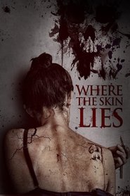 Imagen de Where the Skin Lies
