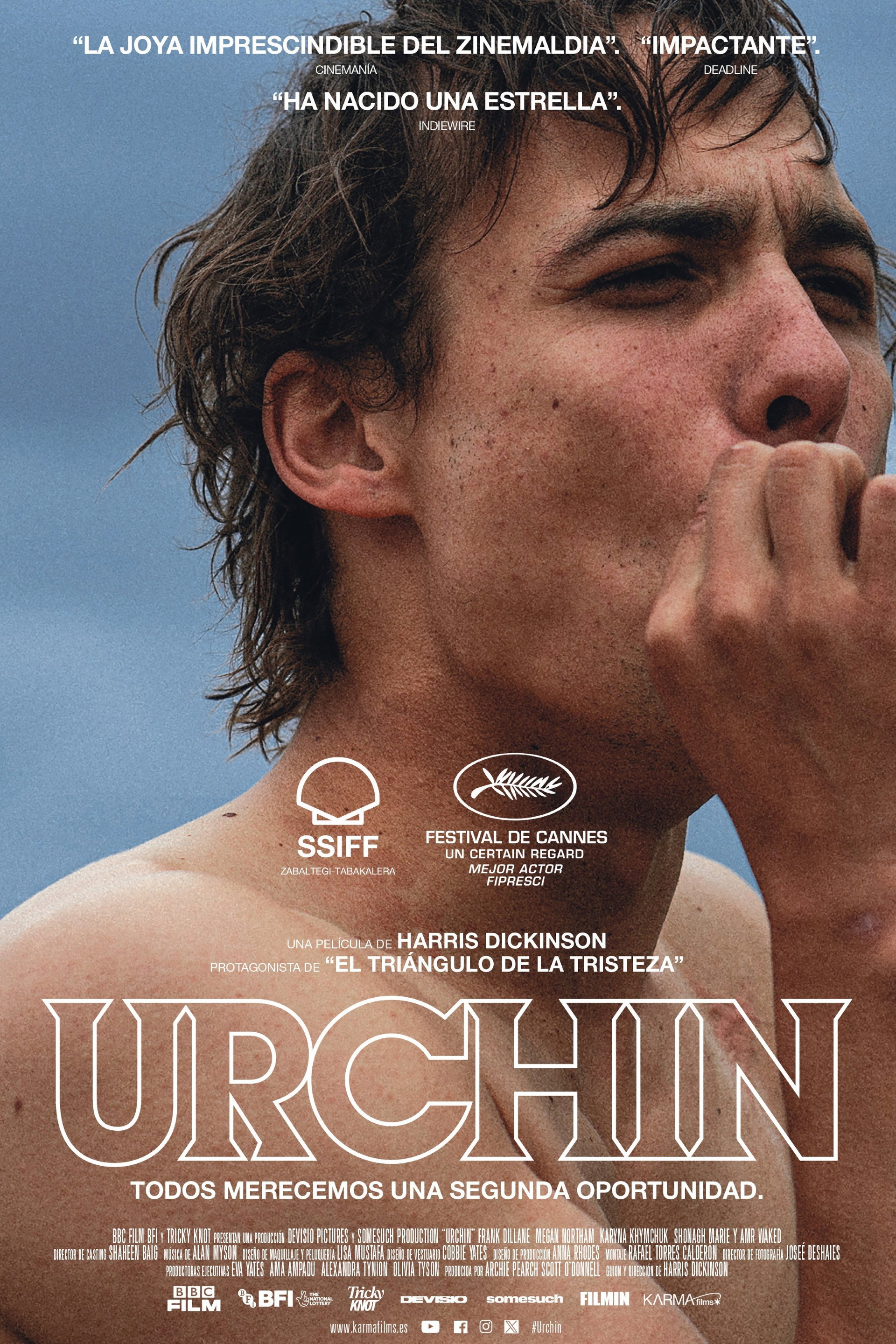 Urchin