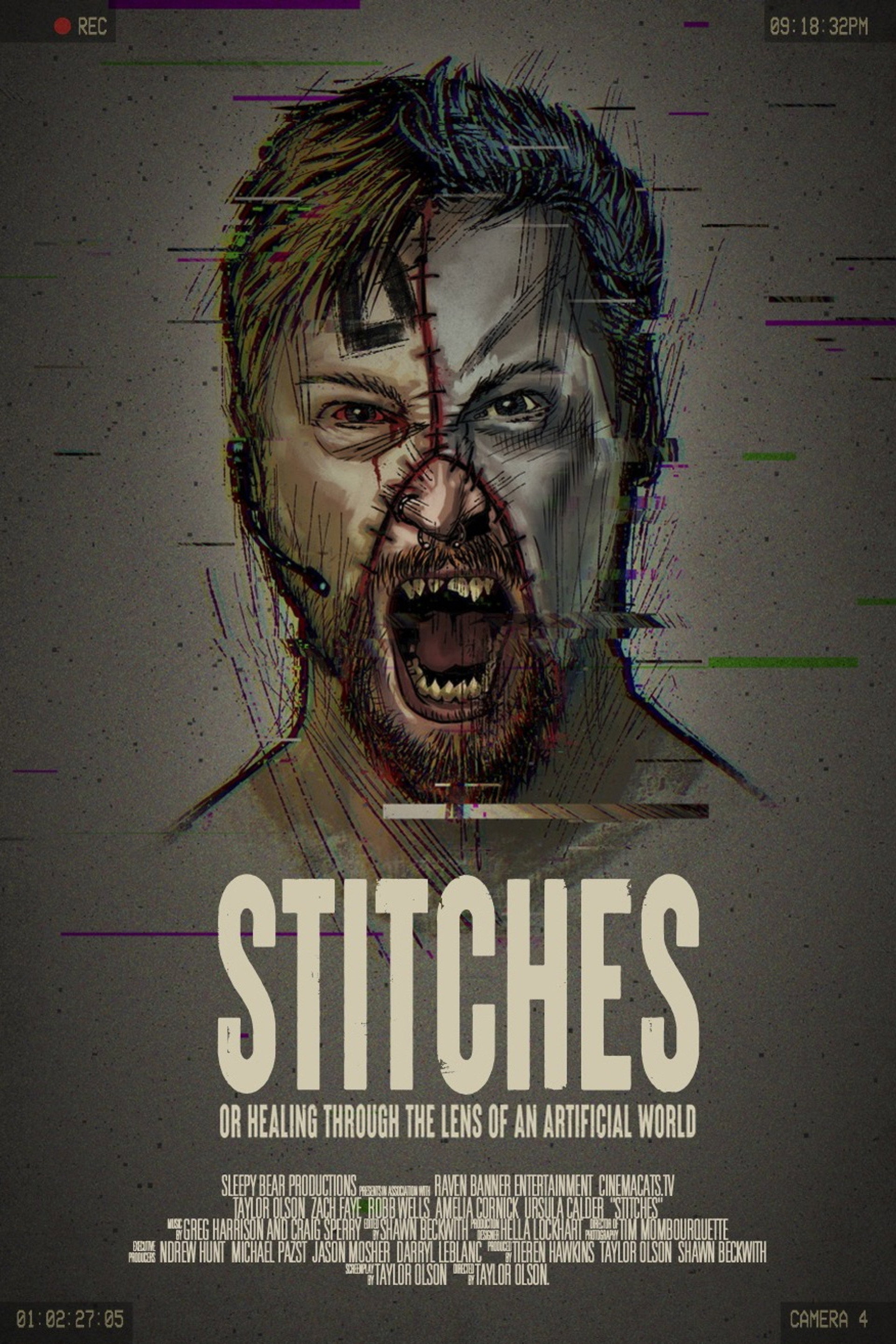 Stitches