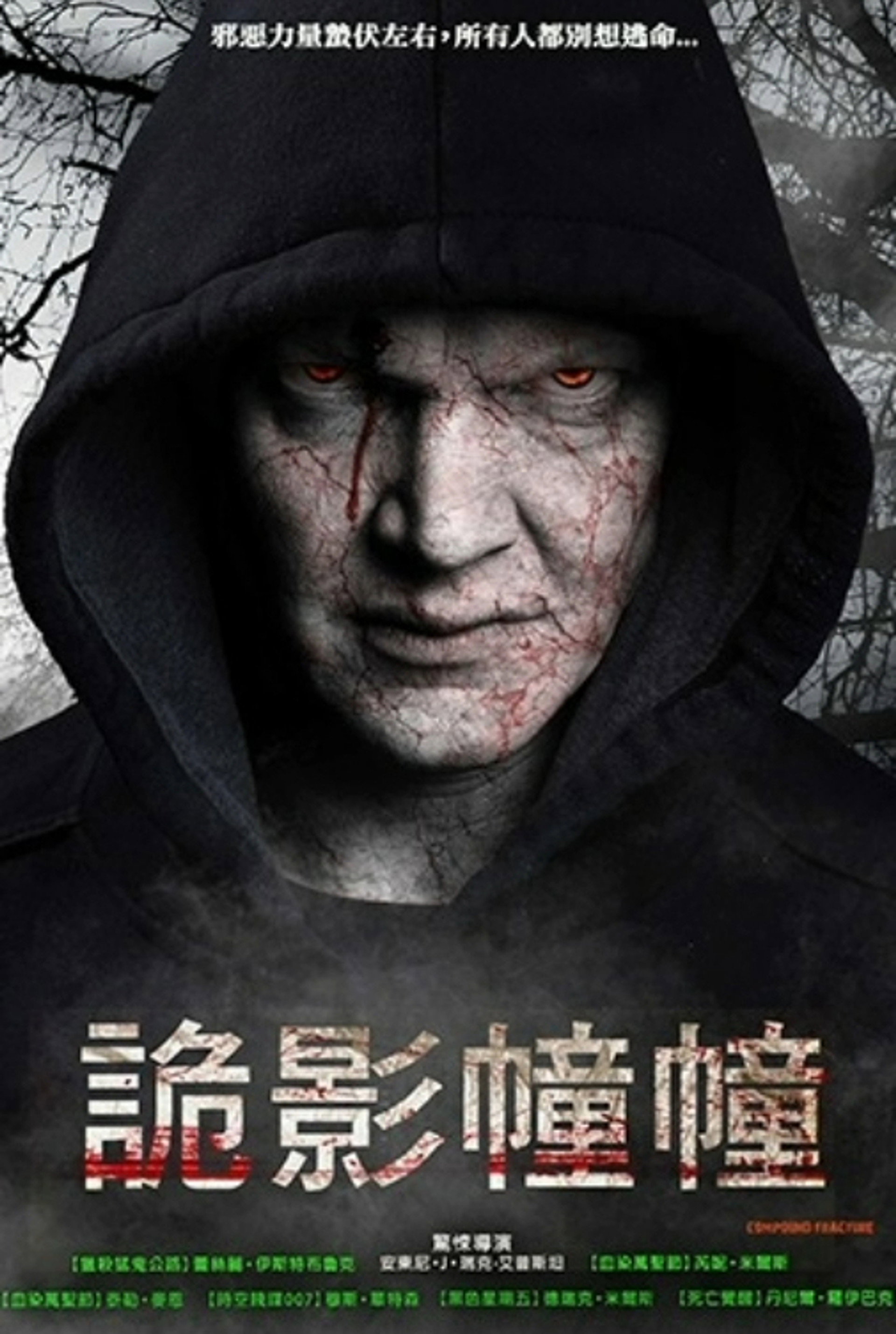 复合骨折
