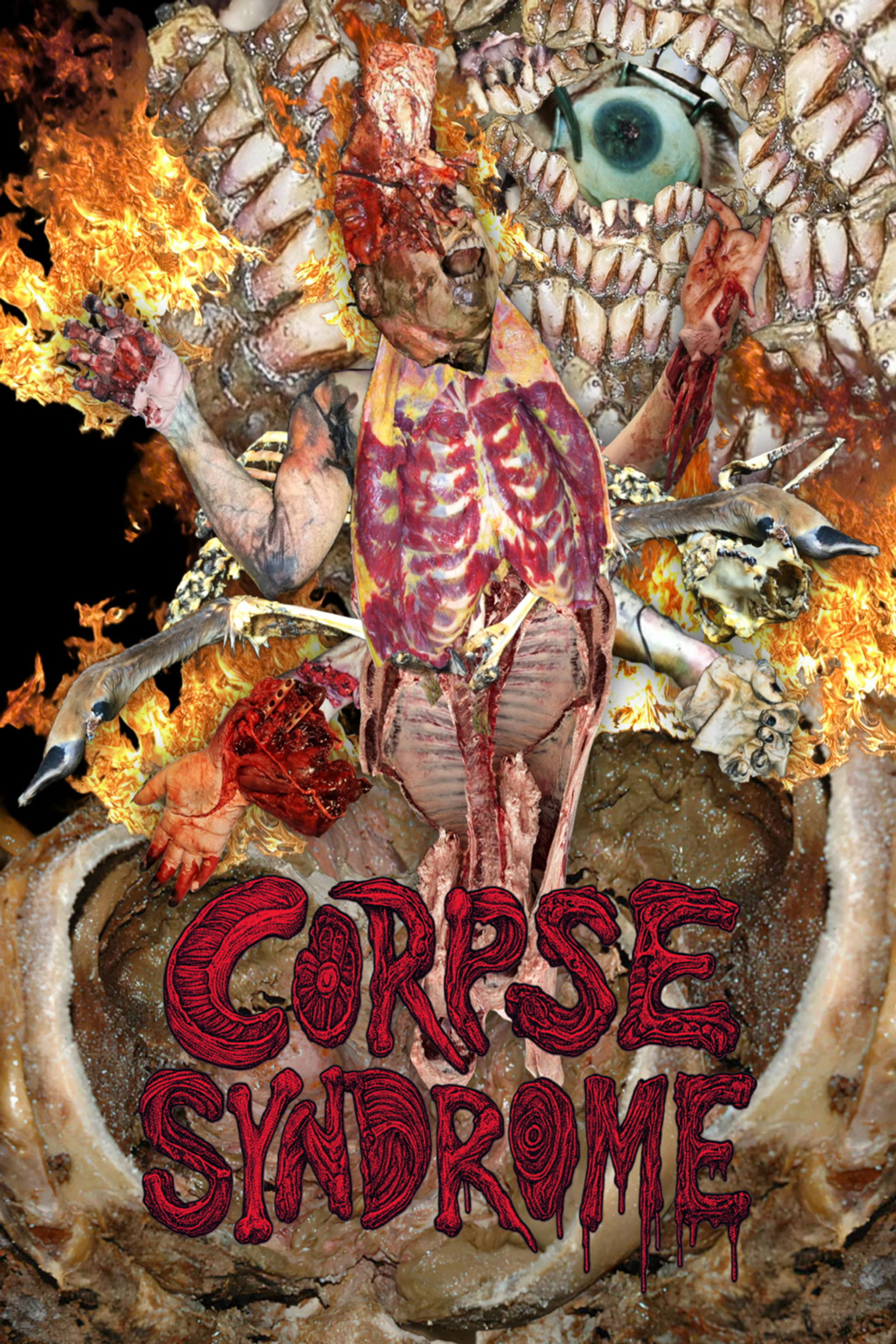 Corpse Syndrome