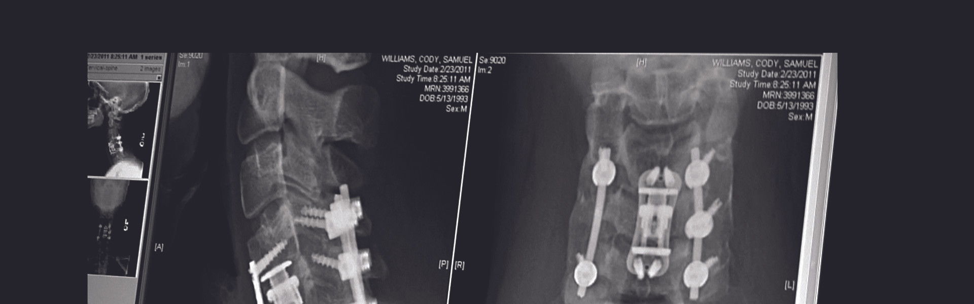 The Hill Chris Climbed: The Gridiron Heroes Story