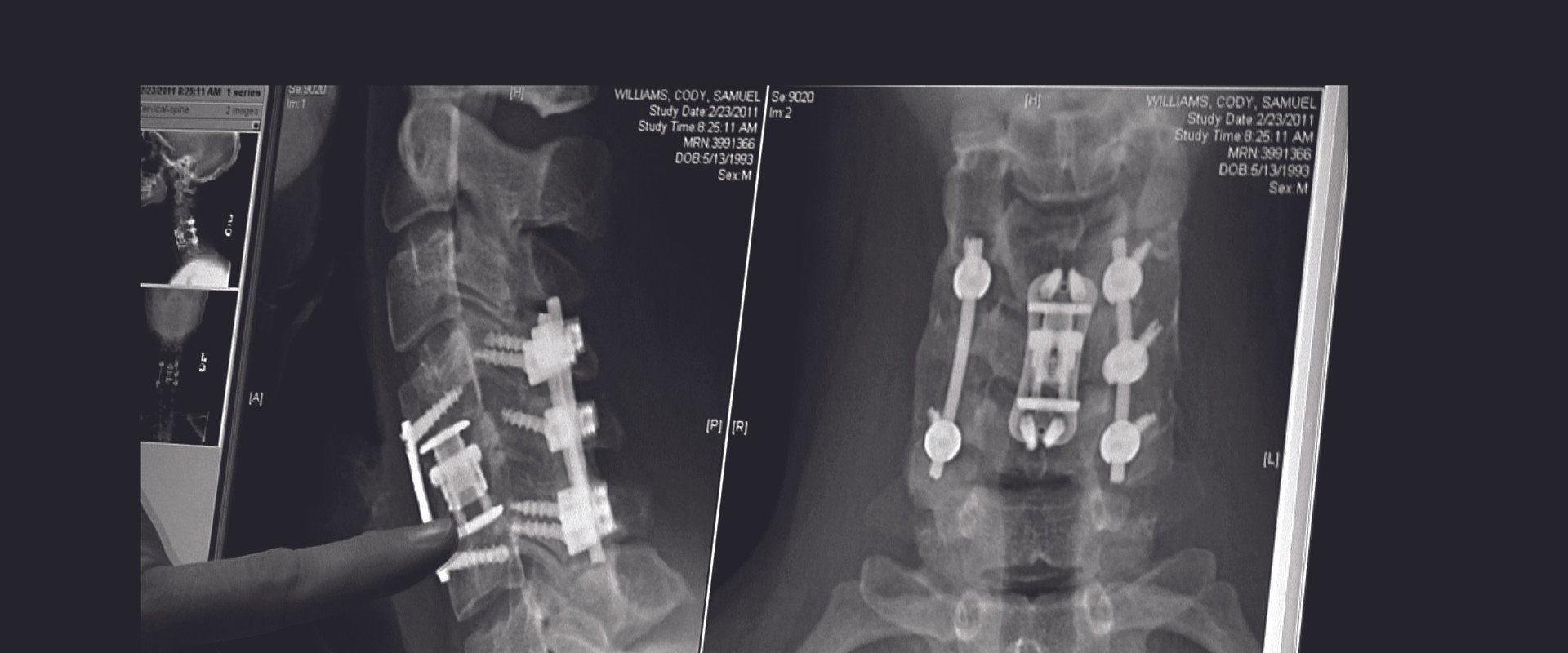 The Hill Chris Climbed: The Gridiron Heroes Story backdrop