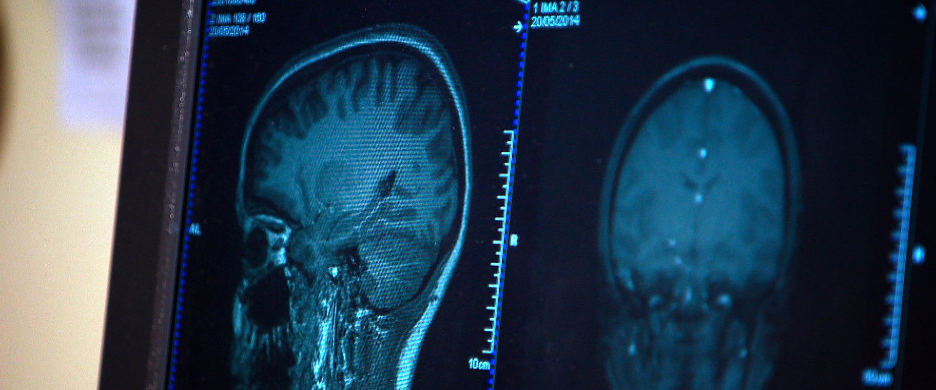 Mind Games's banner image