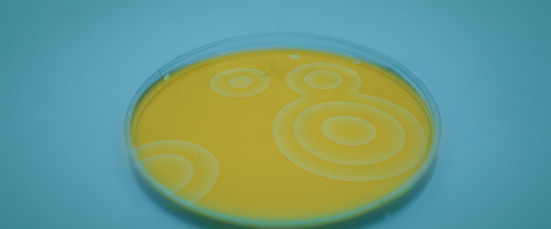 Riproduzione Casuale