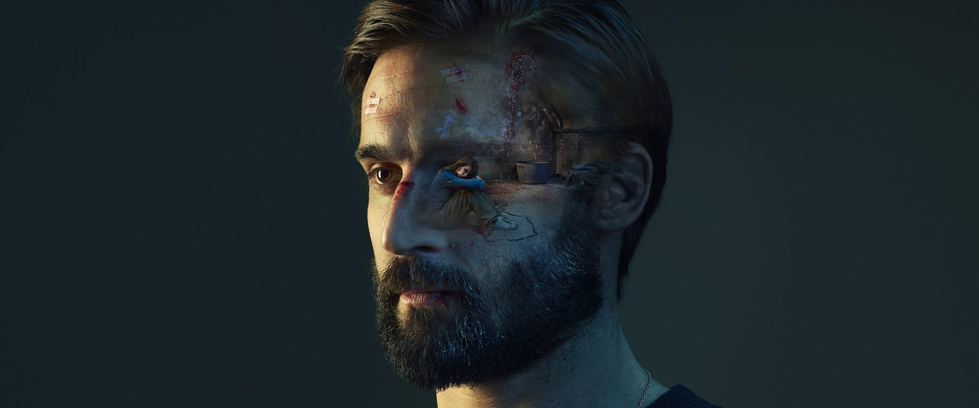 Trauma