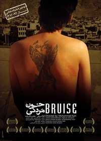 Bruise