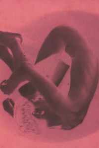 Poster for The Skin of a Napping