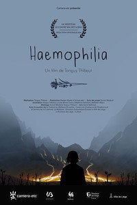 Haemophilia