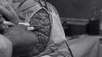 Le Cerveau Qui ne Voulait Pas Mourir