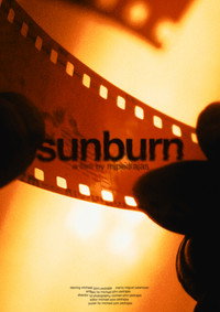 sunburn