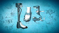 Orthopedics