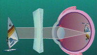 The Eye