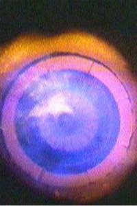 Постер фильма «A Right to Refuse? (1981)» — (1 из 1)