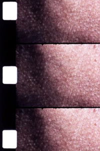 Imagem do Filme Carotid Artery