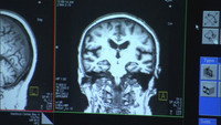 «The Alzheimer's Project (2009)» — обои к сериалу #1