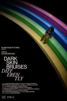 Dark Skin Bruises Differently poster