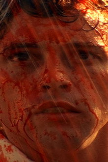 The Ferguson Syndrome