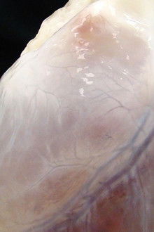 Can We Live Forever?