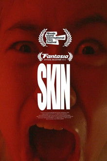 Skin poster