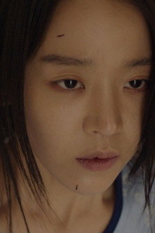Yeon-seo Receives Cornea Donation