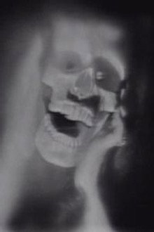 DS-225/226