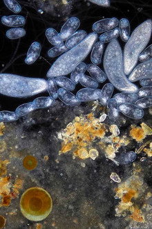 Planeta Microbio