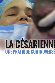 La césarienne - une pratique controversée