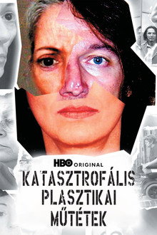 Katasztrofális plasztikai műtétek
