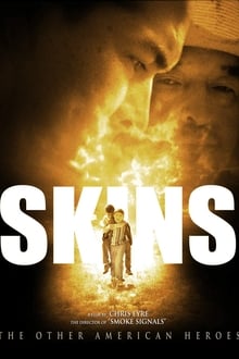 Skins