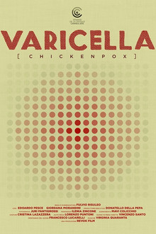 Varicella