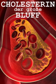 Cholesterin: der große Bluff