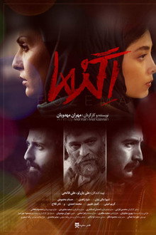اگزما