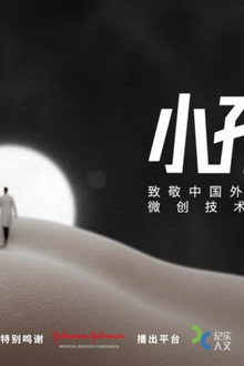 小孔之光