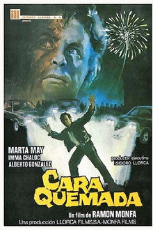 Cara quemada
